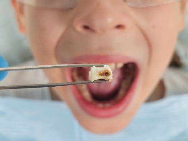 Best Emergency Pediatric Dental Care in Janesville, CA